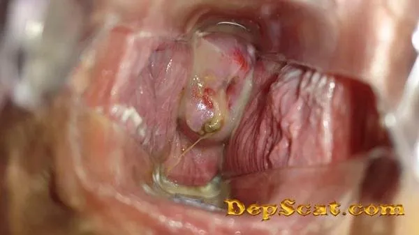 Satin Panty Series – Parts 3 Samantha Starfish - Solo Scat / Extreme [FullHD 1080p/1.86 GB]