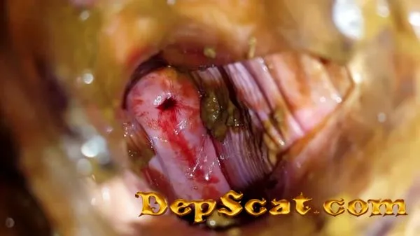 Shit and Blood Vol.5 Speculum Full version Anna Coprofield - Slander, Bull, Solo [FullHD 1080p/1.97 GB] DepScat