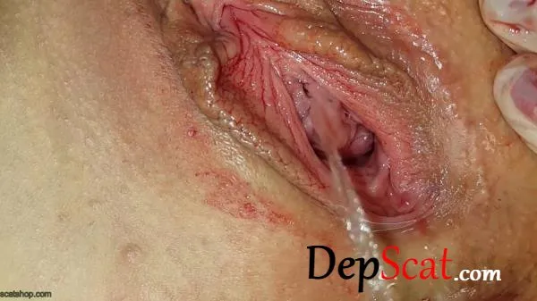 Shit and Blood Vol.8 Speculum Anna Coprofield - Solo, Defecation [FullHD 1080p/3.88 GB] DepScat