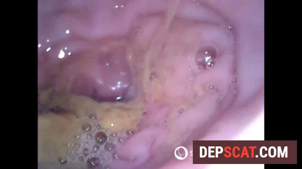 Show Inside Of My Ass With Endoscope Sweet Tinqerbell - Dildo, Anal [FullHD 1080p/378 MB]