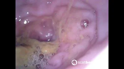 Show Inside Of My Ass With Endoscope Sweet Tinqerbell - Dildo, Anal [FullHD 1080p/378 MB]