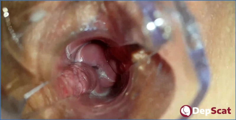 Download Anna Coprofield, HolyShit - Speculum Filled Pussy Scat - FullHD 1080p from DepScat